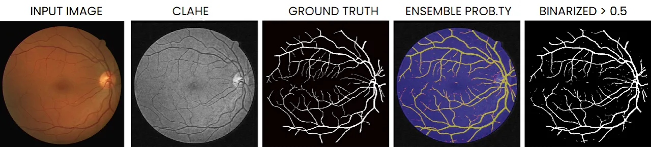Pipeline: input image, CLAHE, ground truth, ensemble probability, binarized mask